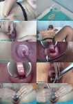 Presents Open cervix with speculum and semen insertion in uterus [HD, 720p]